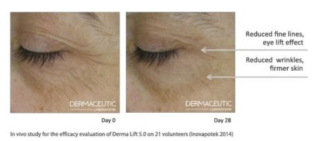 derma-lift-before-and-after