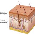 Dermis-img-1